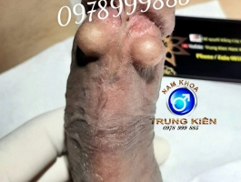 Bộ 3v Cực đẹp Bao cho chị em Mê