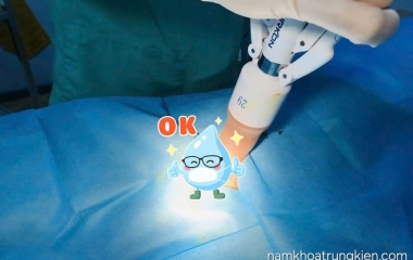 Mùi hôi khó chịu ở Bao Da Quy Đầu Nam Giới 