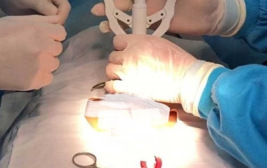 Cắt Bao Quy Đầu Có Giúp Cải Thiện Tình Trạng Xuất Tinh Sớm Hay Không?