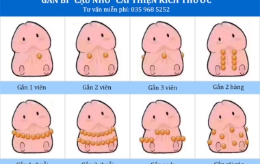 Cấy Bi Có Đau Không? Giải Đáp Chi Tiết Từ Chuyên Gia2