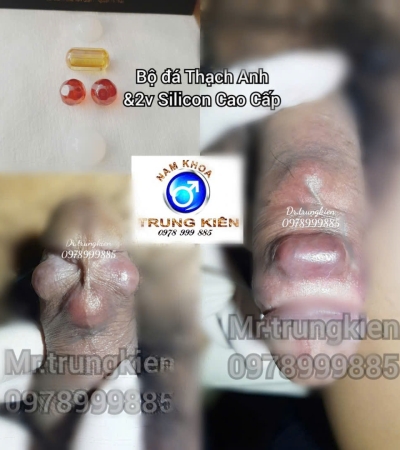 CÁC BỘ BI ĐẸP CHO CẬU NHỎ 