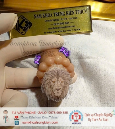 BỘ VÒNG BẠC ĐẠN SILICON 