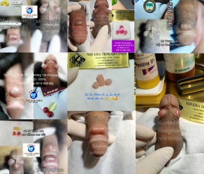 Bộ Bi 3 Điểm Đôn To: Giải Pháp Đa Năng Cho Cảm Giác Thăng Hoa