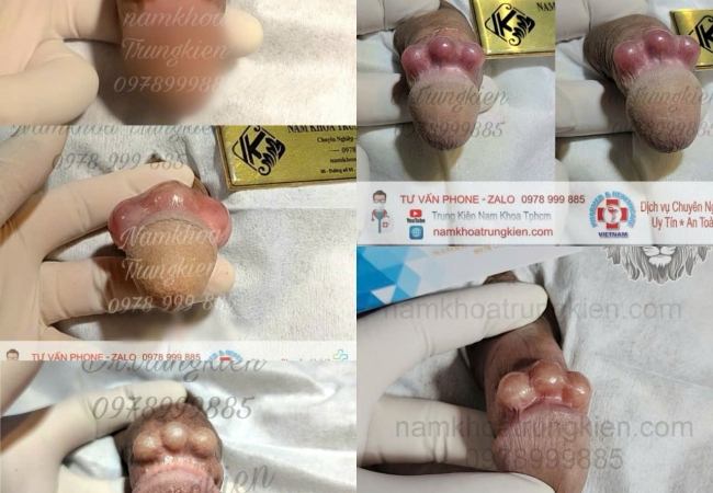 Cách Kích Thích Điểm G Của Phụ Nữ Khiến Nàng Lên Đỉnh Dễ Dàng 