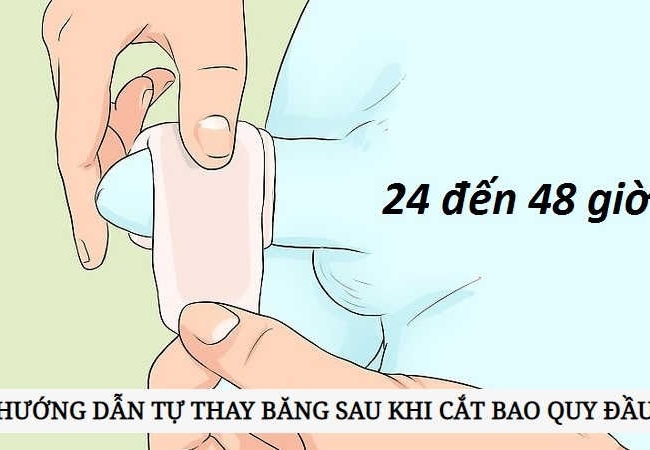Hướng dẫn chăm sóc sau cắt bao quy đầu hiệu quả tại nhà
