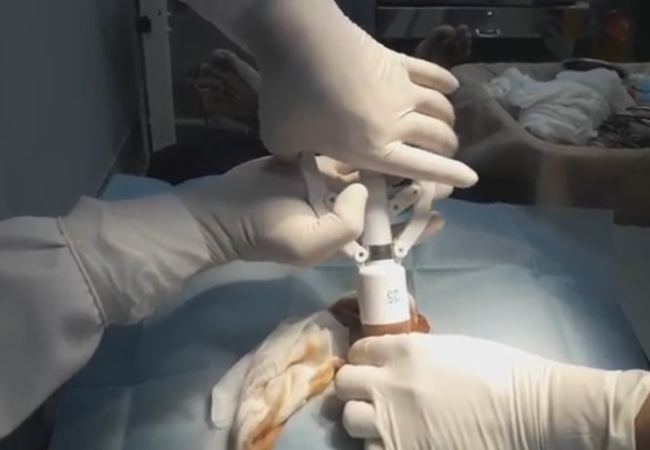 Cắt bao quy đầu gần đây: Địa chỉ uy tín và những điều cần biết