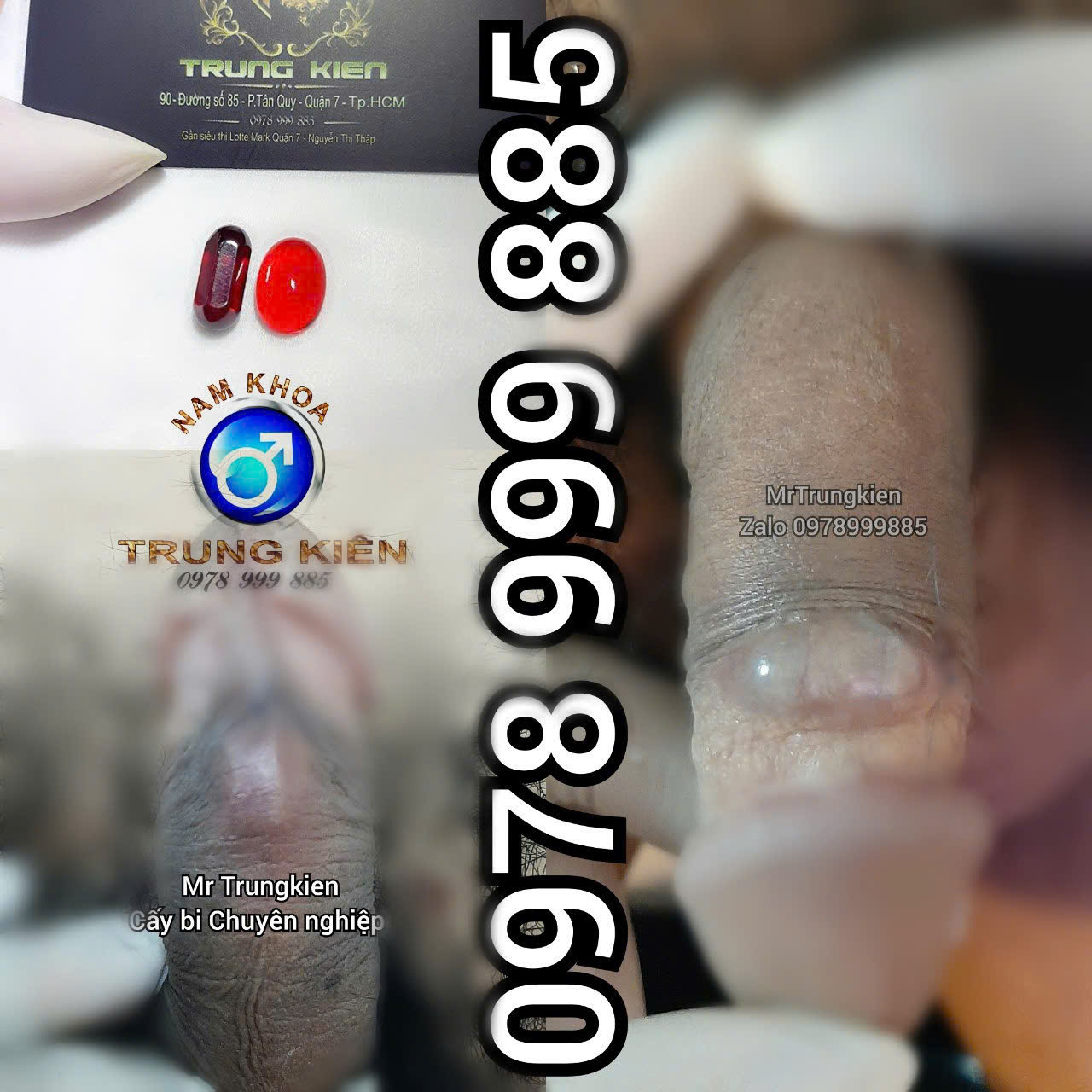 trung-kien-gan-bi-sai-gon.png