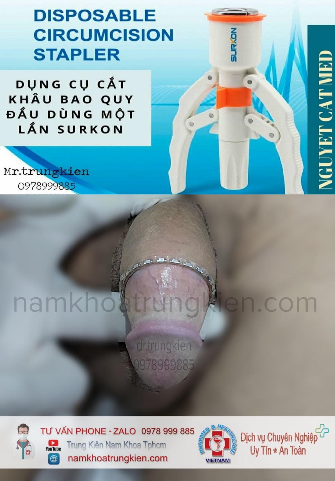 cat-bqd-an-toan.png