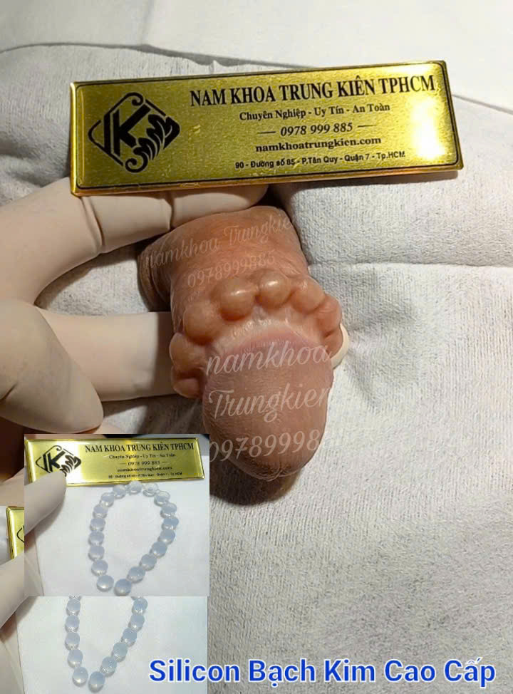 Độ Tuổi Của Đàn Ông Thích Hợp Để Cấy Bi – Hiểu Đúng, Làm Đúng