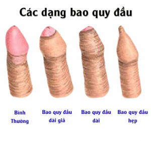 mui-hoi-bao-quy-dau-du-dai.png