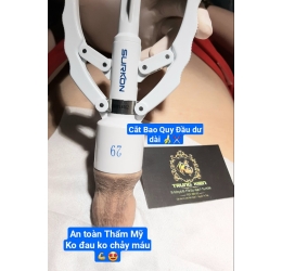 Cắt Bao Quy Đầu An Toàn bằng Máy SURKON