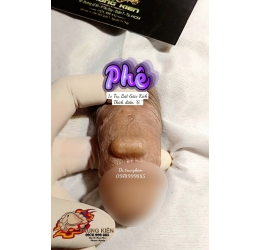 Cấy Bi Găm Bi Cậu Nhỏ 1v Bát Giác Điểm G - NAM KHOA TRUNG KIÊN quận 7 Tphcm 