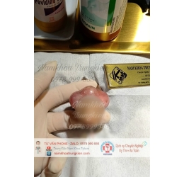 BỘ 3V ĐÔN TO KÍCH CỠ HIỆU QUẢ 