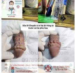 Hình ảnh gắn bi cậu nhỏ