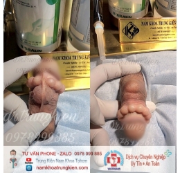 Cấy Bi giúp Đôn To cậu nhỏ hiệu quả - Cấy Bi an toàn Hcm