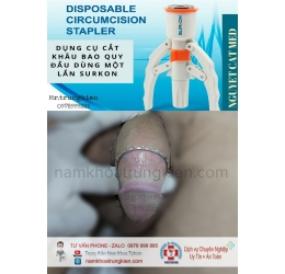 Hình ảnh cắt bao quy đầu cho Nam giới 