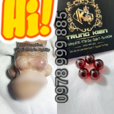 Bộ Bi 5v xoay vòng Bạc Đạn 
