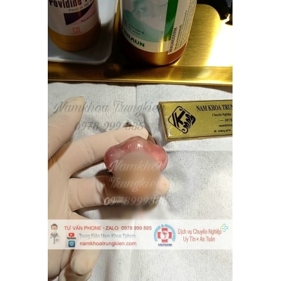 BỘ 3V ĐÔN TO KÍCH CỠ HIỆU QUẢ 
