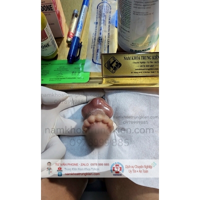 Bộ Bi siêu kích thích đôn to hiệu quả cho Cậu em 