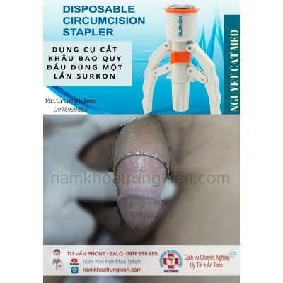 Hình ảnh cắt bao quy đầu cho Nam giới 