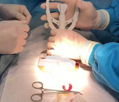 Cắt Bao Quy Đầu Chuyên Nghiệp