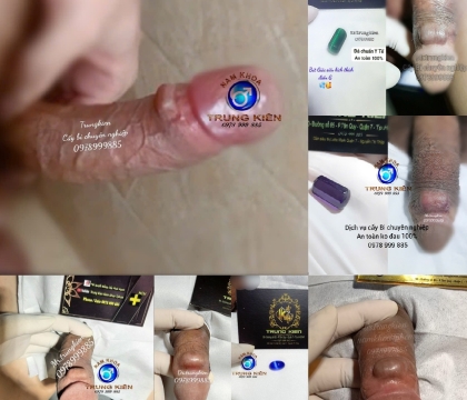 Viên Kích Thích Điểm G: Chìa Khóa Đến Sự Thỏa Mãn Tuyệt Đối