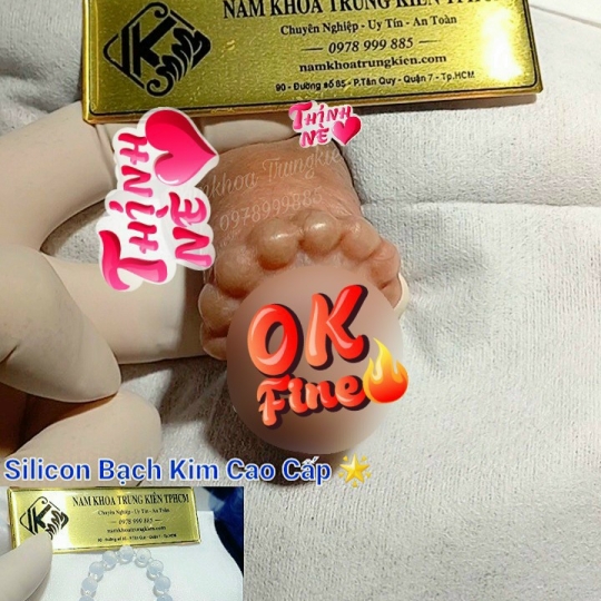 Các sản phẩm Bi đá cao cấp nam khoa chuyên nghiệp An toàn tuyệt đối