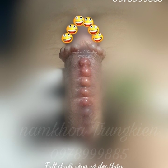 Cấy bi Chuỗi dọc thân Cậu Nhỏ 