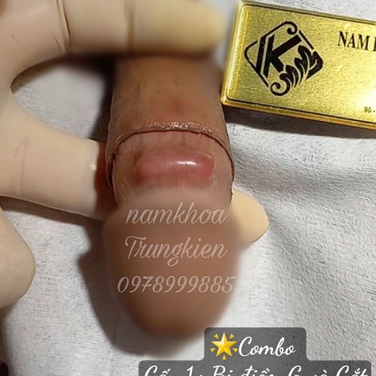 Cấy Bi giúp Đôn To cậu nhỏ hiệu quả - Cấy Bi an toàn Hcm