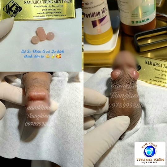 Các sản phẩm Bi đá cao cấp nam khoa chuyên nghiệp An toàn tuyệt đối