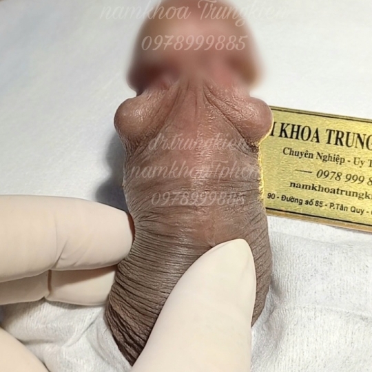 Cấy Bi Full cho Cậu Nhỏ 