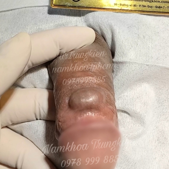 Bộ Bi siêu kích thích đôn to hiệu quả cho Cậu em 