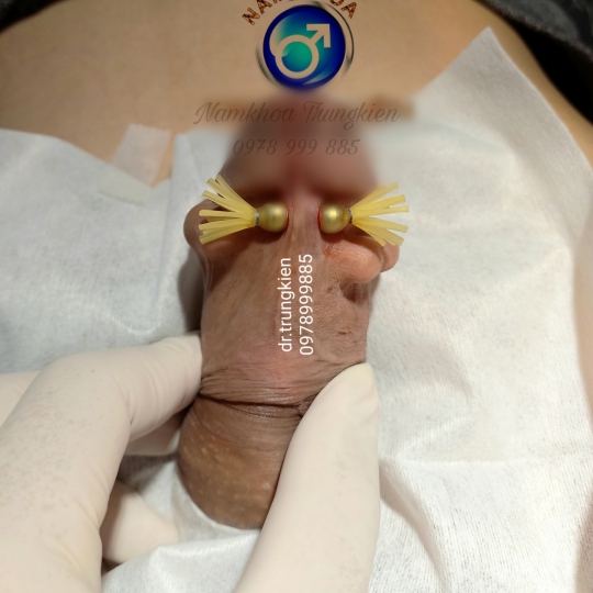 Cấy Bi Full cho Cậu Nhỏ 