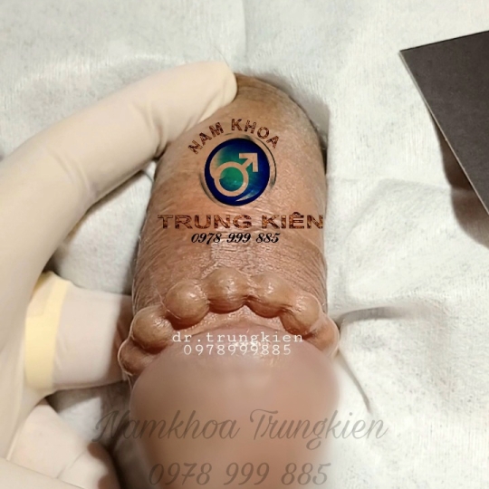 Bộ Bi siêu kích thích đôn to hiệu quả cho Cậu em 