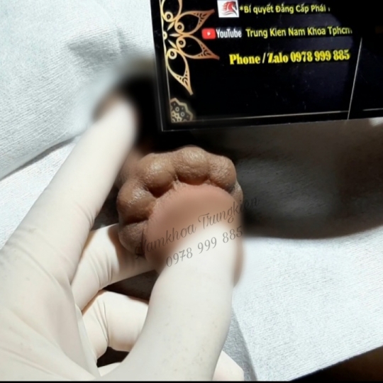 Cấy Bi Full cho Cậu Nhỏ 
