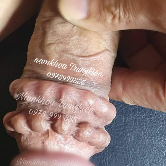 Hình ảnh gắn bi cậu nhỏ