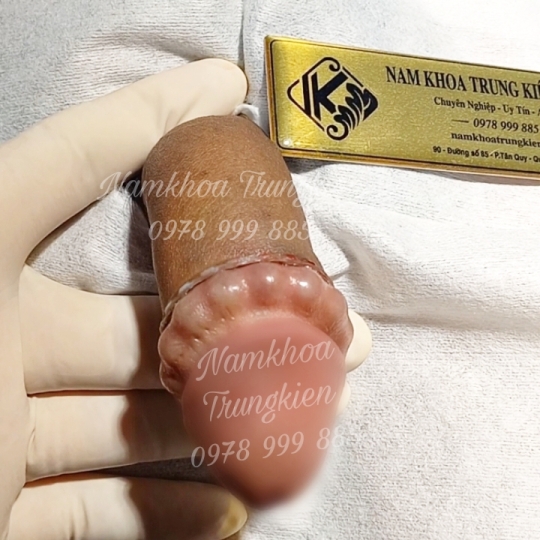 Cấy Bi Full cho Cậu Nhỏ 