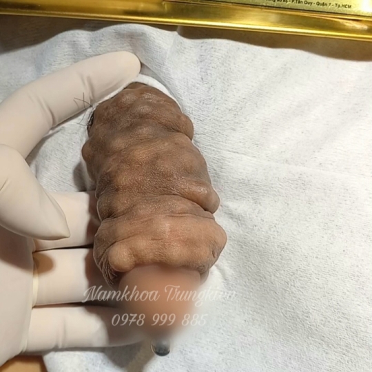 Bộ Bi siêu kích thích đôn to hiệu quả cho Cậu em 