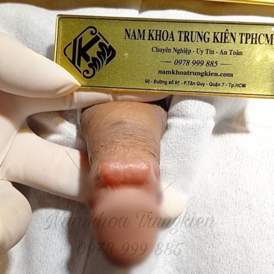 Bộ Bi siêu kích thích đôn to hiệu quả cho Cậu em 
