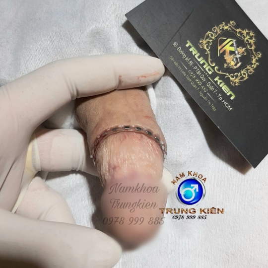 Bộ Bi siêu kích thích đôn to hiệu quả cho Cậu em 