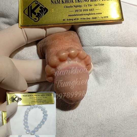 Cấy Bi Full cho Cậu Nhỏ 