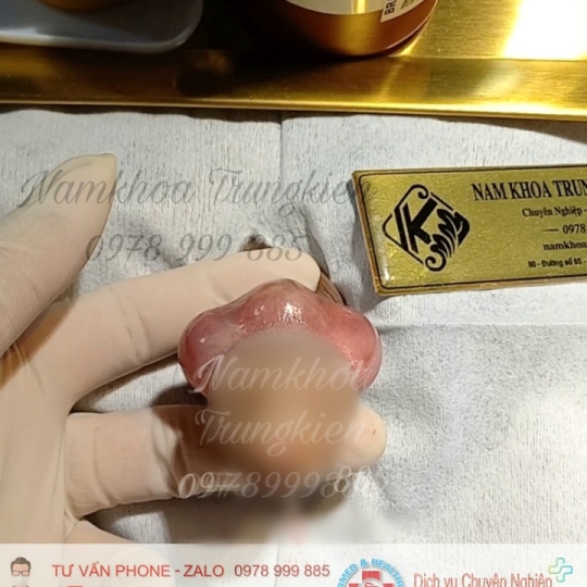 BỘ 3V ĐÔN TO KÍCH CỠ HIỆU QUẢ 