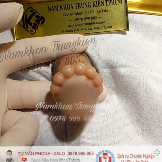 Các sản phẩm Bi đá cao cấp nam khoa chuyên nghiệp An toàn tuyệt đối