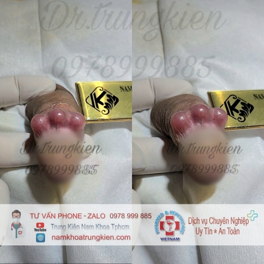 Bộ Bi siêu kích thích đôn to hiệu quả cho Cậu em 