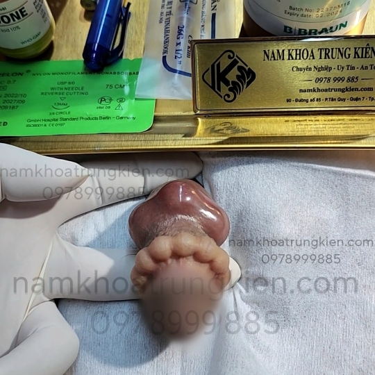 Bộ Bi siêu kích thích đôn to hiệu quả cho Cậu em 