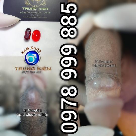 Bộ 3v Bi đá Cao Cấp Đá Ruby