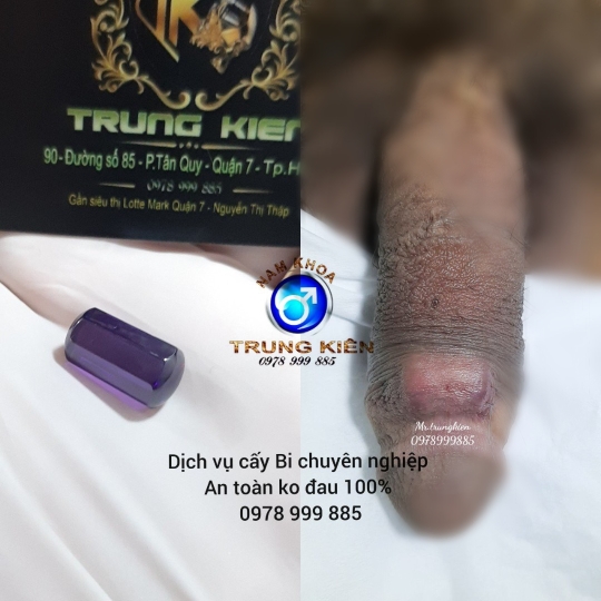 Bộ 3v Bi đá Cao Cấp Đá Ruby