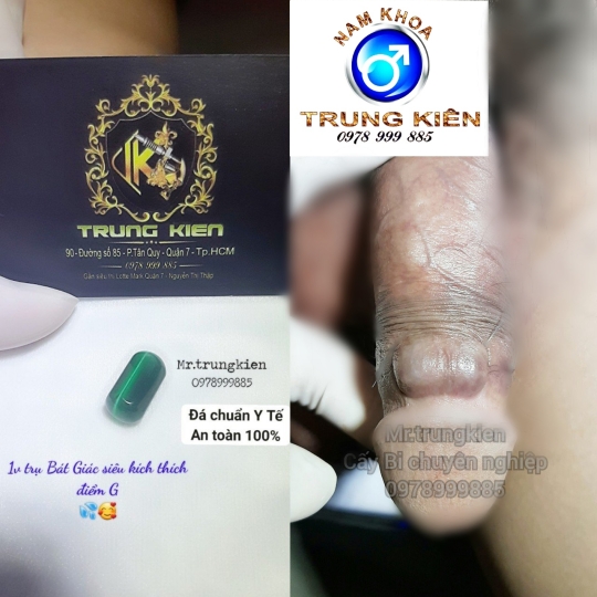 Hình ảnh cắt bao quy đầu an toàn 100% ko Đau