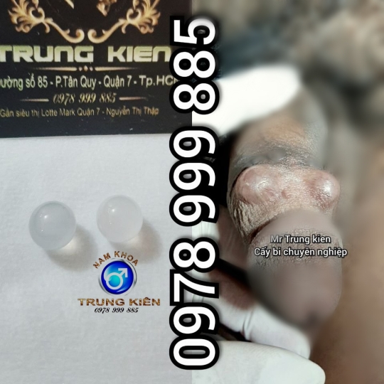 Hình ảnh cắt bao quy đầu an toàn 100% ko Đau