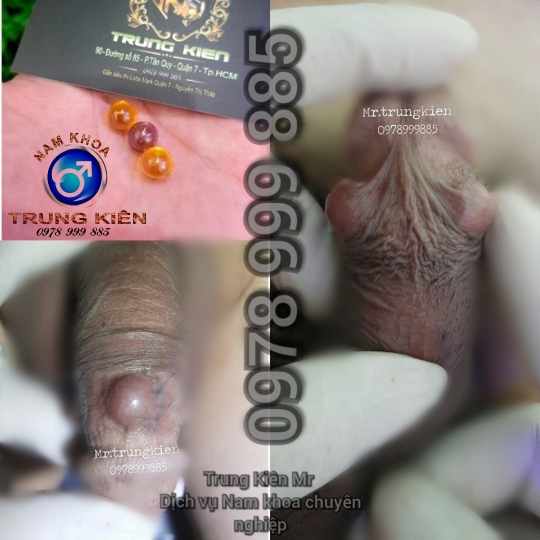 Chuỗi Bạc Đạn 2 vòng Bi 